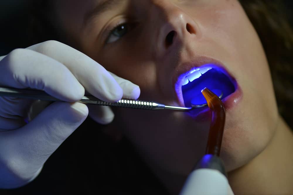 Dental_procedures_that_increase_revenue